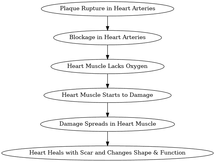 Simple Flowchart describing the mechanism a of Heart Attack - Dr. Biprajit Parbat - HEARTVEDA