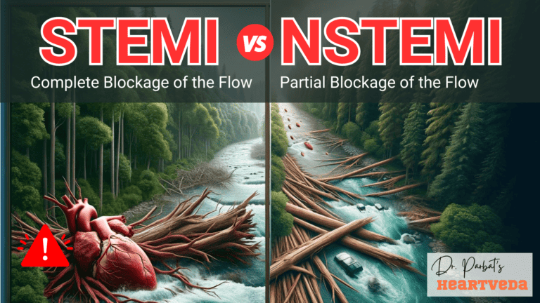 STEMI Heart Attacks: Most Dangerous Type of Heart Attack?