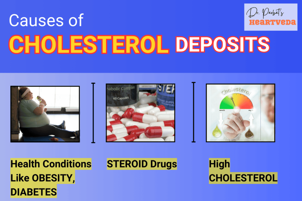 Causes of cholesterol deposits - Dr. Biprajit Parbat - HEARTVEDA